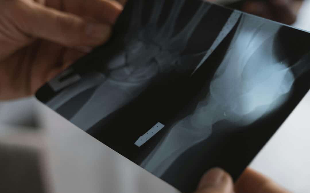 Medical Aid Tax Credits South Africa: MTC Explained