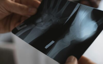 Medical Aid Tax Credits South Africa: MTC Explained